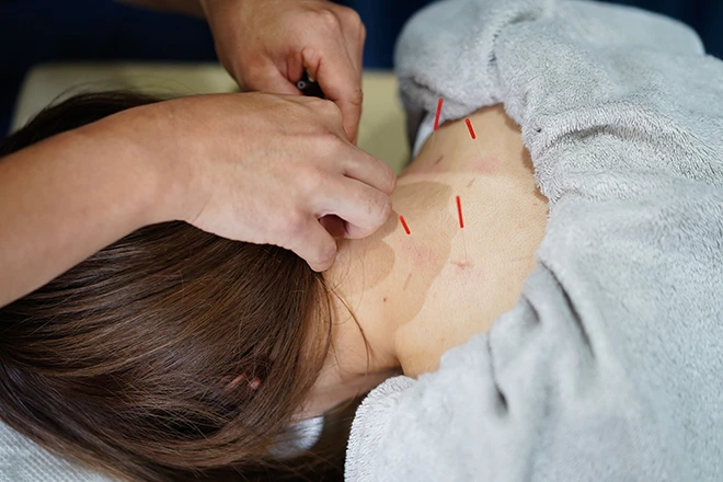 健康と美を手に入れる、あなたのための鍼灸・接骨院